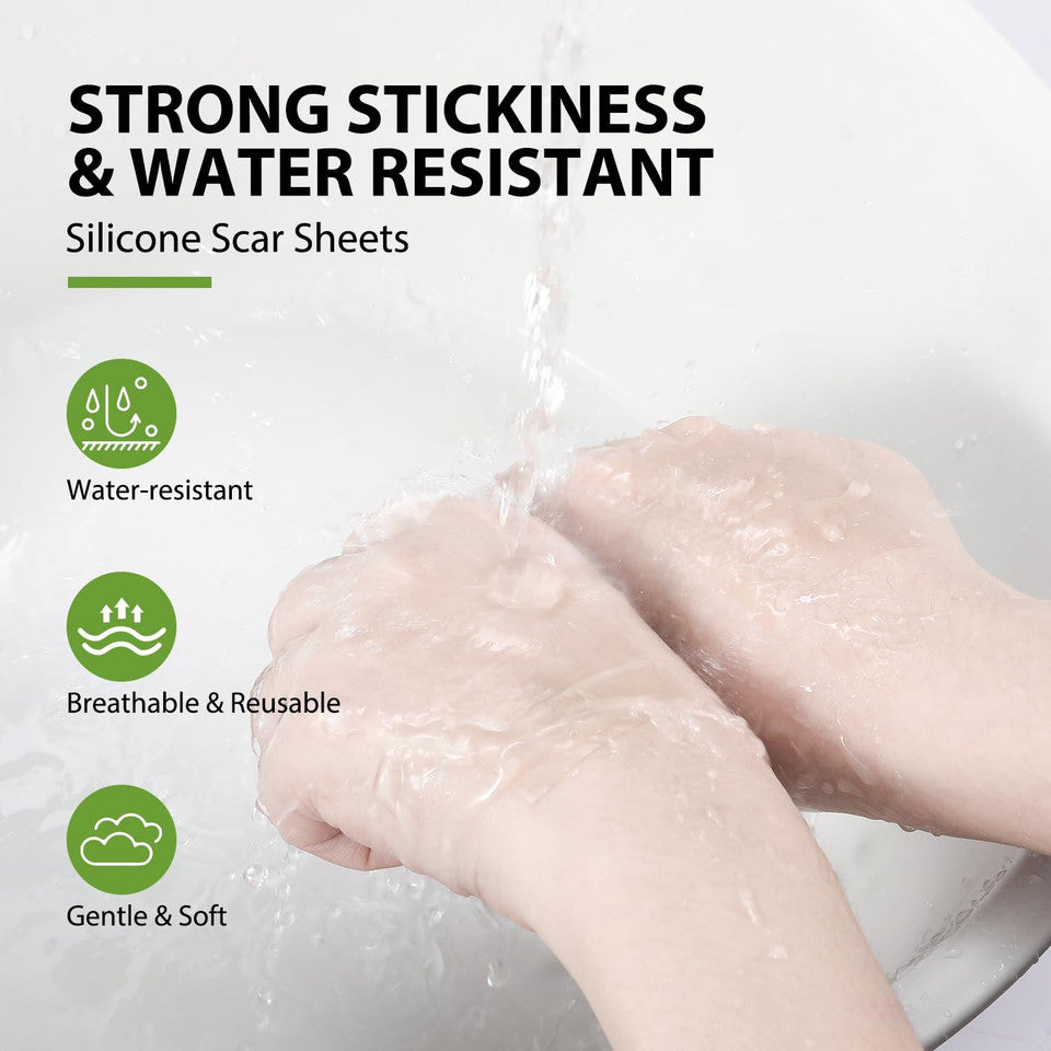 Medical Grade Silicone Scar Tape – Advanced Repair Roll (1.6" x 60")